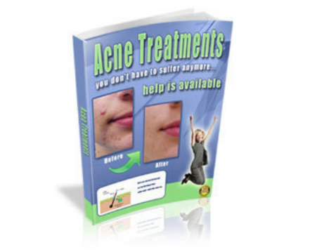 Acne Treatments